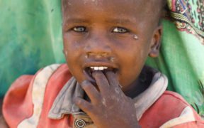 MALNOURISHED CHILD SOMALIA